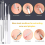 Σετ αφαίρεσης μαύρων στιγμάτων Comedone Extractor - 10 τεμάχια αφαίρεση 5