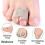 Toe Splints 10PCS Toe Bandages Padding for Broken Toe Crooked Toe Alignment 4
