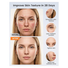Mascarilla Facial LED Inalámbrica: Terapia de Luz Roja para el Rejuvenecimiento de la Piel, Tratamiento del Acné y Reducción de Arrugas con
