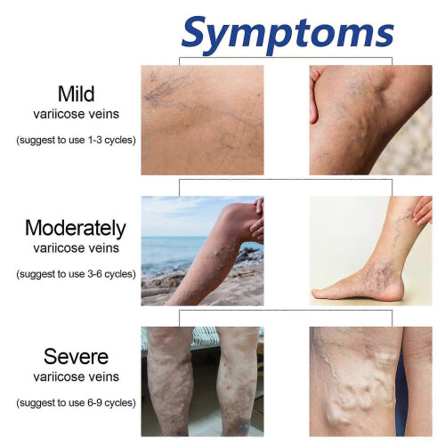 Intravenous Massage Spray 2