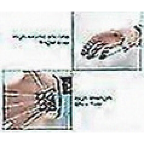 Finger Extensor Trainer Hand Yoga Resistance Band Strength Trainer 40 lbs 1