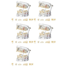5X Disease Teeth Model Dental Typodonts Implant Teeth Model with Removable Teeth Dentist Standard Tooth Demonstration
