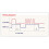 4X AC100V-220V Adjustable Timer Control Relay Module Turn Off Delay  Board for Exhaust Fan Mr22 19 6