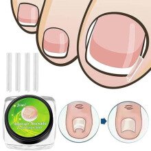 (Wie abgebildet, 10PCS/Box) 10Pcs Ingrown Toenail Correction Pad Toenail Filler Tool Foot Care Kit