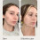 Brightening and Cleansing Serum Reduces Discolouration, PostBlemish Marks 50ml 4