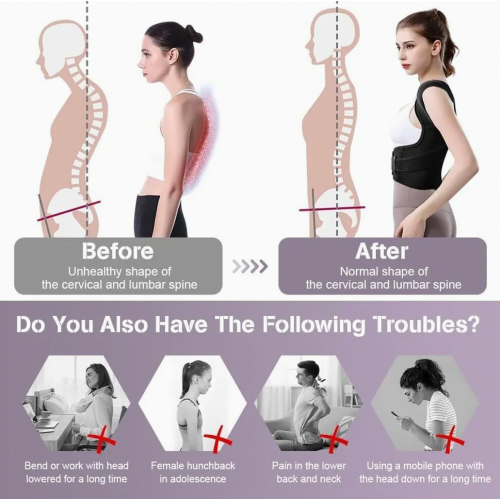 Posture corrector, posture trainer for women and men, adjustable back straightener, breathable shoulder strap, back support. 2