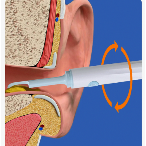 Ear cleaner WiFi Visual with high-resolution camera gyroscope 1