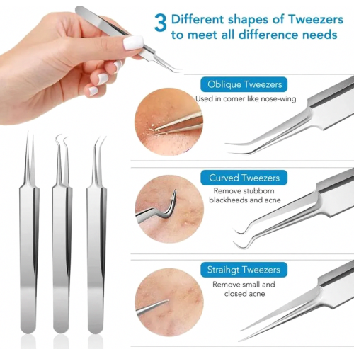 Blackhead remover set, 15-piece, pimple remover set, acne tools 1
