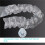 1set Replacement Tips: Plastic Suction Tips for Skin Rejuvenation, Deep Cleansing (Beauty Device Accessory) White 2