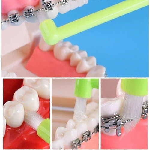 Toothbrush, Tuft Compact Toothbrush, Angle Interdental Brushes, Tufted Toothbrushes, 4 Orthodontic Toothbrushes, Small Compact Interden 2