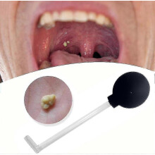 Kit de aspiración para remover cálculos amigdalinos. Herramienta de limpieza bucal dental para el cuidado de la boca.