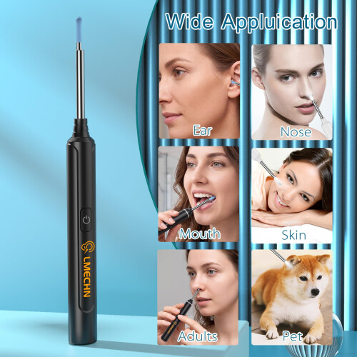 Ear Wax Removal Kit 1926P HD Visual Ear Cleaner 2