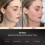 AMIRO R1 Pro RF Facial Device, Black 5