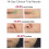 AMIRO R1 Lift RF Beauty Device,Pink 5