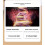 AMIRO R3 Turbo Frequency Beauty Device,Gold 3