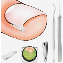 60 Piece Ingrown Toenail Correction Kit with Patches, Nail Clippers, Nippers and Tweezers for Pedicure