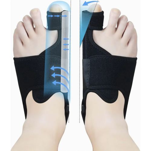 Bunion Corrector with 2 Adjustable Splints, Non-Slip Strap, Toe Separator and Protector, 1 Pair