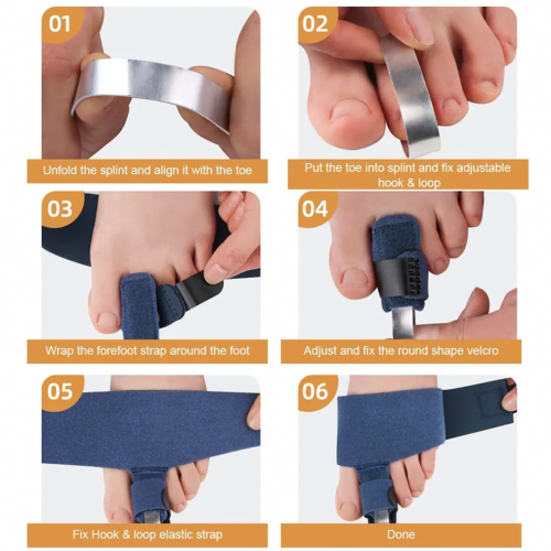 Toe Separator Splints for Hammer Toe Alignment, Toe Straightener Straps for Men and Women, 2 Pack 2