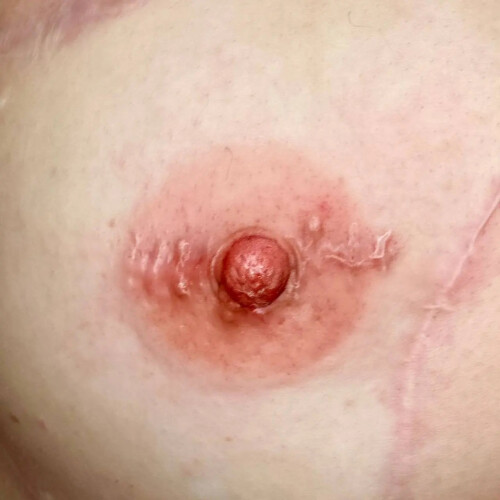 Hanafy Areola No.2 Riga – Areola Pigment 1