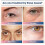 Micro-Current Eye Massager Red Light Pulse Face Massage Face Eye Beauty Artifact Reduce Dark Circles 5