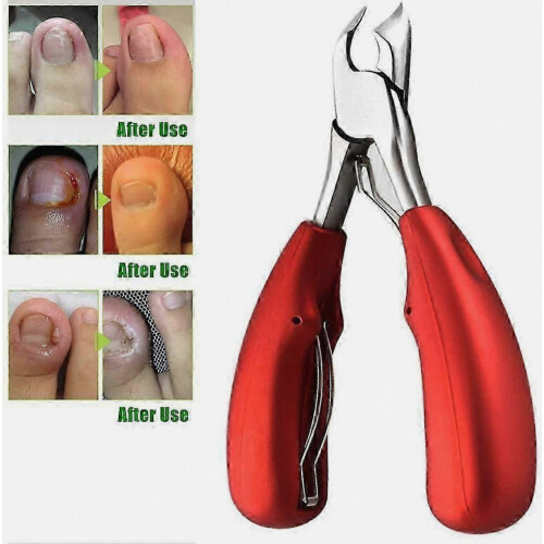 Professional Ingrown Toenail Clipper - Thick Nail Precision Straight Blade Tool