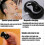 Anti Snoring Device, 2026 Most Effective Snoring Solution, New Device For Snoring And Sleep Apnea,reduces Snoring 3