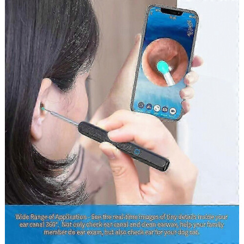 NE3 Smart Visual Ear Cleaner with LED Light Camera - Wireless Ear Wax Removal Tool 2