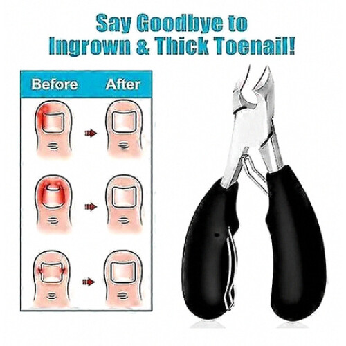 Toenail Clippers, Sharp Stainless Steel Blades, For Thick Nails 1