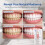 Uryske Toothpaste Whitening, Uryske Toothpaste for Yellow Teeth，2 2