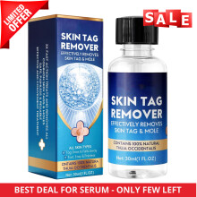 STRONG SKIN TAG REMOVER SERUM NATURAL TREATMENT MOLES WARTS and TAGS
