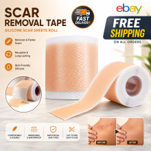 MEDICAL GRADE Scar Removal Tape Silicone Scar Sheet Treatment Patch UK