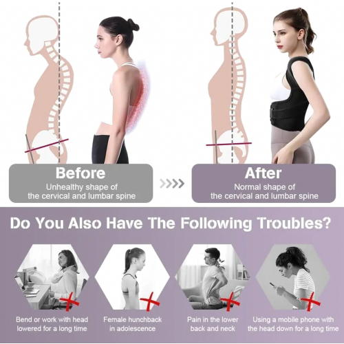 Posture Corrector for Women and Men, Adjustable Back Support Brace, Breathable Shoulder Strap, Size M 1