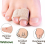 6 Pack Hammer Toe Correctors, Toe Splints and Supports for Crooked, Overlapping or Broken Toes 3