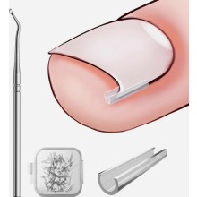 Kit per la correzione dell'unghia incarnita, 40 strisce raddrizzanti indolori per unghie con strumento per sollevare l'unghia.