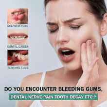 (5) Spray para el dolor de muelas, tratamiento de úlceras bucales, alivio del dolor de muelas, periodontitis,