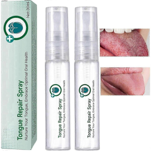(2pcs) Σπρέι επιδιόρθωσης γλώσσας, εξολοθρευτής οσμής στόματ