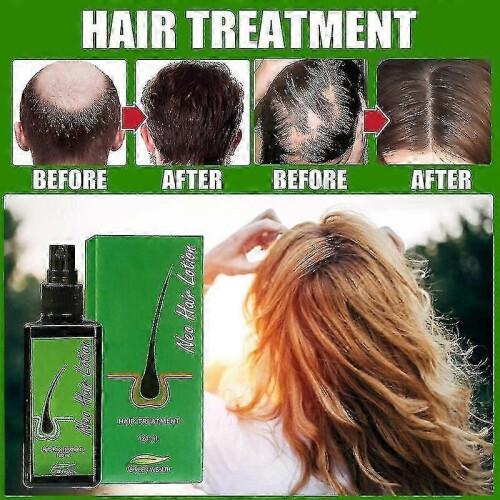 (120ml) Νέα λοσιόν μαλλιών Thailand Neo 120ml Essence κατά της τριχόπτωσης, θ 1