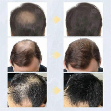 (Light Brown) Spray volumizzante alla cheratina con fibre, 9 colori per capelli, prodotti per la crescita e lo sviluppo