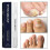 (3pcs) Αντιμυκητιασικό Στυλό Undecylenic Acid 25% Φροντίδα Νυχιών Ποδι 1