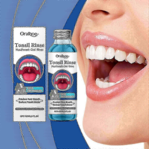 (2PCS) tonsil stone removal liquid 120ml for bad breath and tonsils 25-26 1