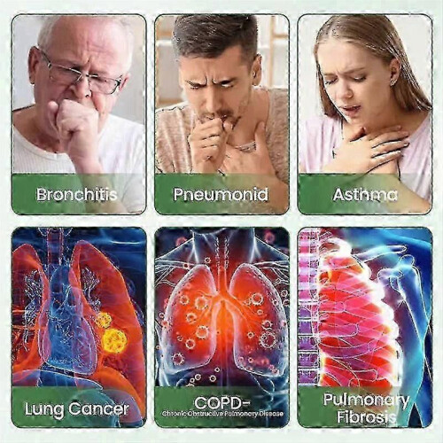 (4PCS) 2026-1-5x Εισπνευστήρας CalmDerm, Φυτικός εισπνευστήρας CalmDerm, Φυ 1