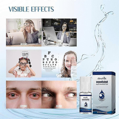 (2PCS) 1-10x Βελτίωση Όρασης Οφθαλμικές Σταγόνες Υψηλής Ποιότητ 1