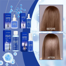 (Type #4) Jaysuing Koperpeptide Follicle Revitalizing Hair Growth Series