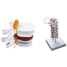1 pieza de modelo didáctico de esqueleto de columna vertebral y disco lumbar de anatomía humana y 1