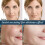 60pcs Collagen Silk Threads, Face Lifting, Collagen Silk Threads For Lifting Thread Lifting For Skin 3