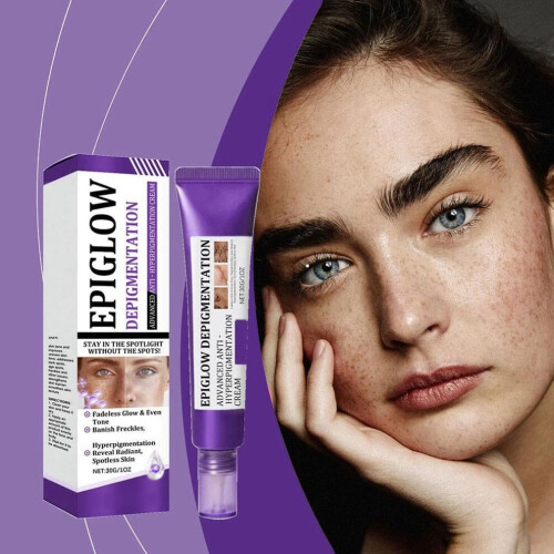 2X EPIGLOW MelanEX Advanced Anti-Hyperpigmentation Cream 1
