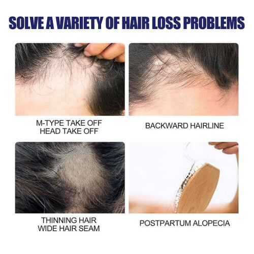 3x Extra Sterke Haargroeibehandeling voor Mannen, Schuimpak 60g 1