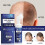 3x Extra Sterke Haargroeibehandeling voor Mannen, Schuimpak 60g 3
