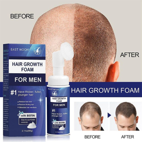 3x Extra Sterke Haargroeibehandeling voor Mannen, Schuimpak 60g 2