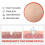 Blusoms Microdarts Tag'gone Patch, neutroera Blusoms Pro Microdarts Taggone Patch 2